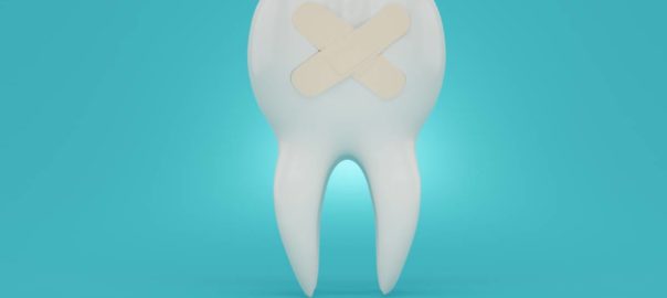 Tooth with root canal bandage on blue background to explain how dental inlays and onlays are different.