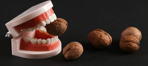 featured image for repairing a chipped or broken tooth