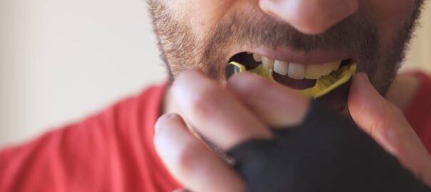 Featured image for Do You Need to Wear a Mouthguard While Playing Sports?